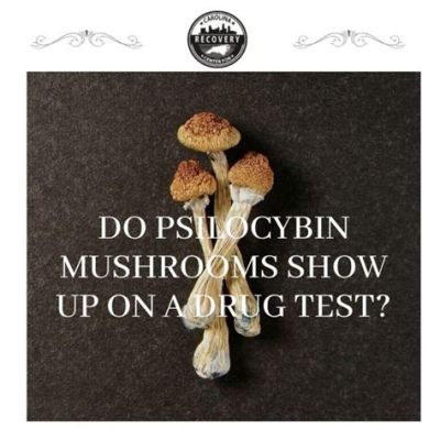 Does Mushrooms Show Up in a Drug Test: A Journey Through the Psychedelic and the Practical